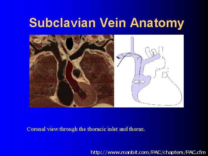 Subclavian Vein Anatomy Coronal view through the thoracic inlet and thorax. http: //www. manbit.