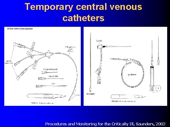 Temporary central venous catheters Procedures and Monitoring for the Critically Ill, Saunders, 2002 Temporary central venous catheters Procedures and Monitoring for the Critically Ill, Saunders, 2002