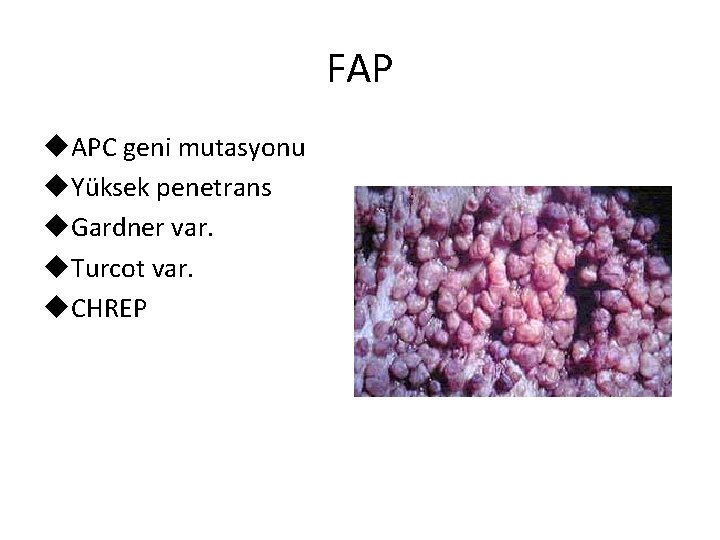 FAP u. APC geni mutasyonu u. Yüksek penetrans u. Gardner var. u. Turcot var.