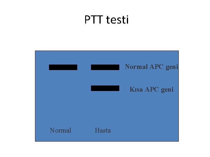 PTT testi Normal APC geni Kısa APC geni Normal Hasta 