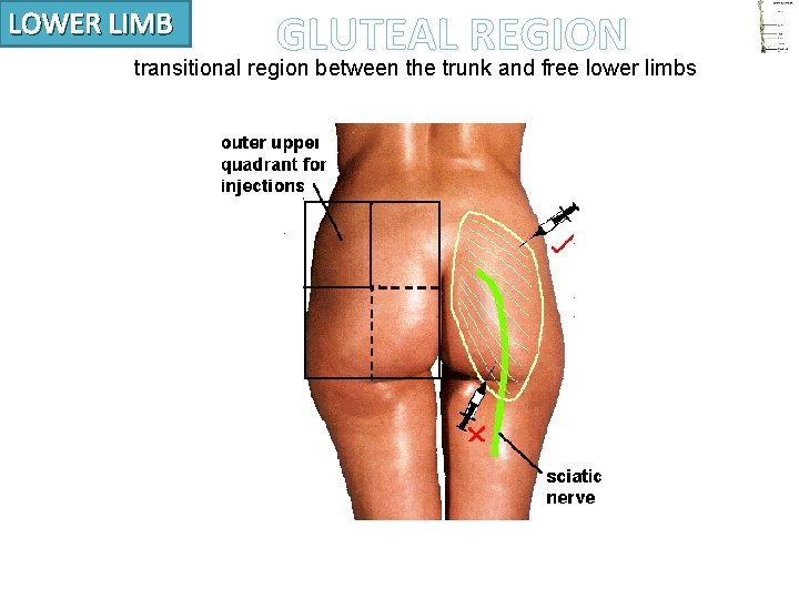 LOWER LIMB GLUTEAL REGION transitional region between the trunk and free lower limbs 
