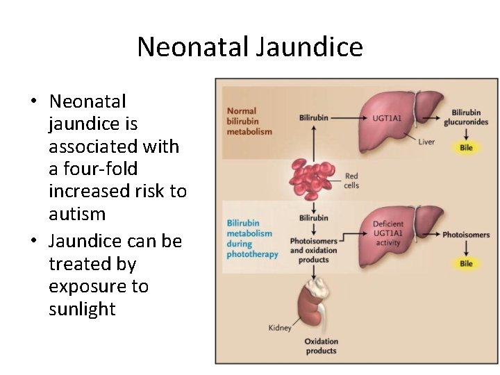 Neonatal Jaundice • Neonatal jaundice is associated with a four-fold increased risk to autism