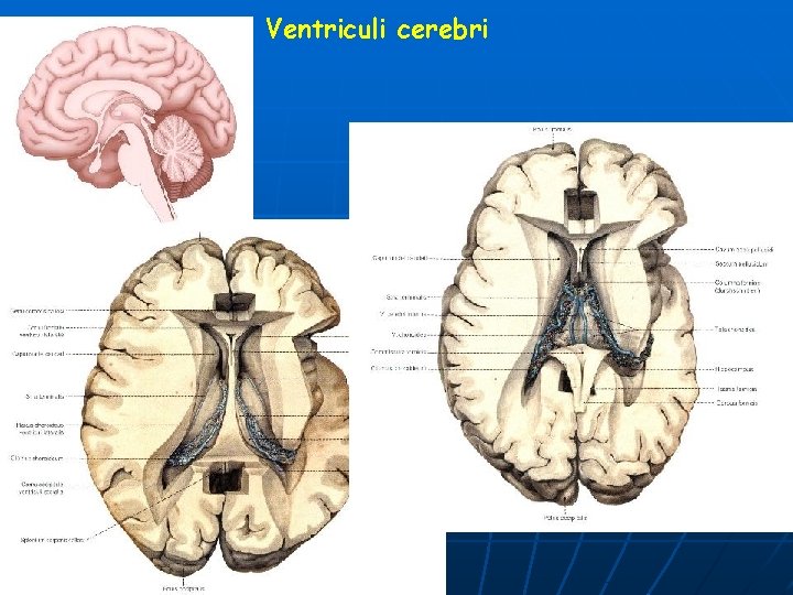 Ventriculi cerebri 