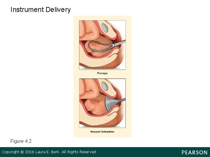 Instrument Delivery Figure 4. 2 Copyright © 2016 Laura E. Berk. All Rights Reserved