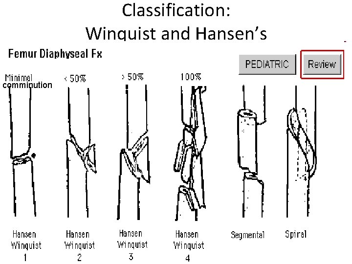 Classification: Winquist and Hansen’s comminution 
