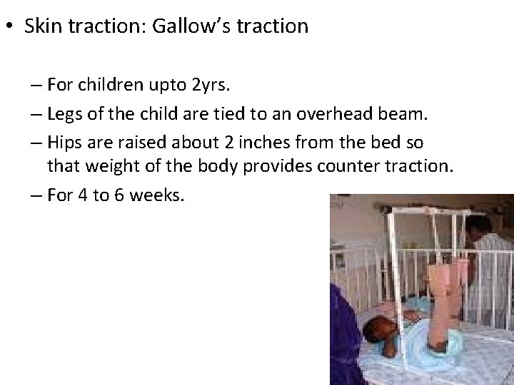 • Skin traction: Gallow’s traction – For children upto 2 yrs. – Legs
