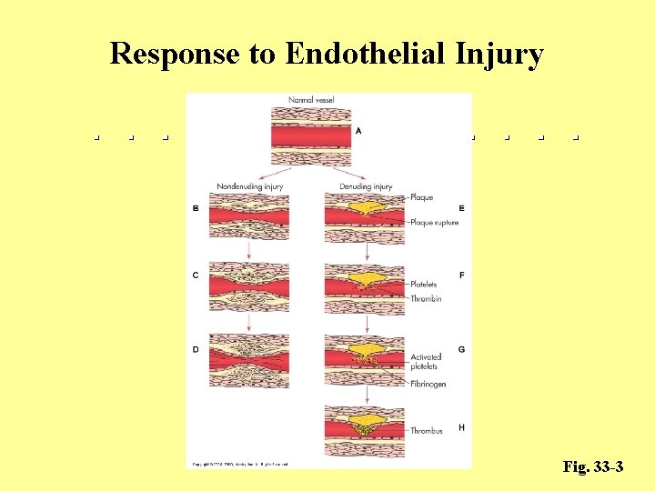 Response to Endothelial Injury Fig. 33 -3 