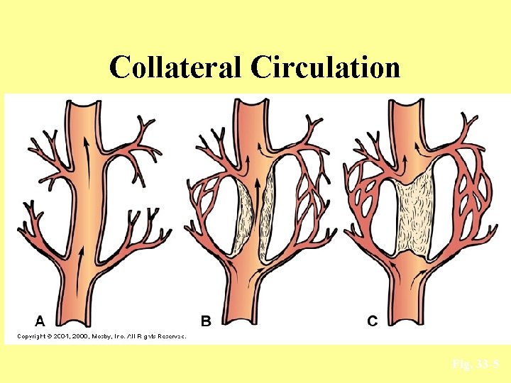 Collateral Circulation Fig. 33 -5 