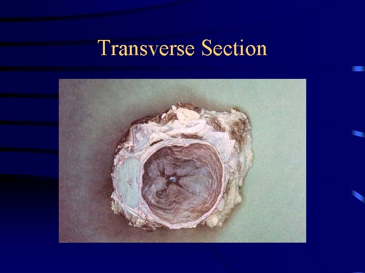 Transverse Section 