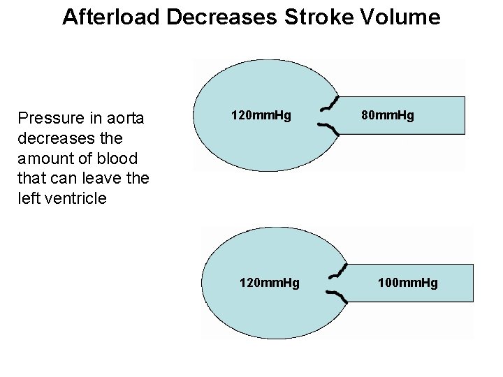 Afterload Decreases Stroke Volume Pressure in aorta decreases the amount of blood that can