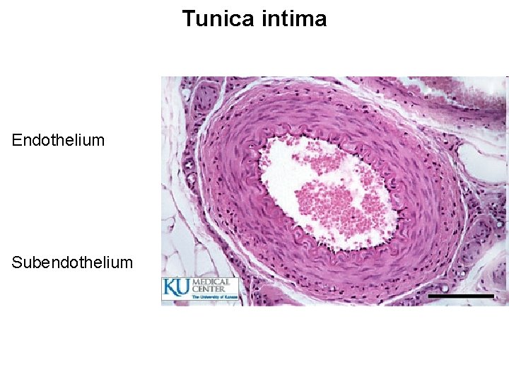 Tunica intima Endothelium Subendothelium 
