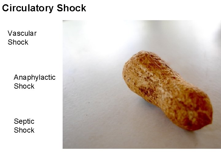 Circulatory Shock Vascular Shock Anaphylactic Shock Septic Shock 