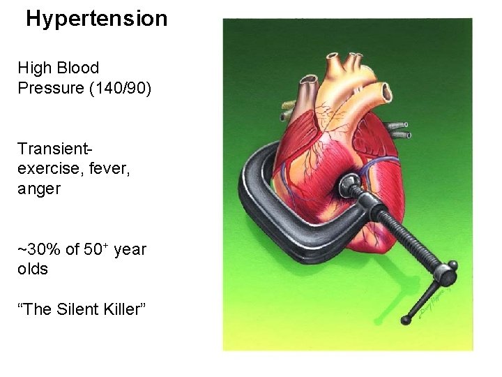 Hypertension High Blood Pressure (140/90) Transientexercise, fever, anger ~30% of 50+ year olds “The