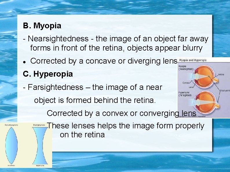 B. Myopia - Nearsightedness - the image of an object far away forms in