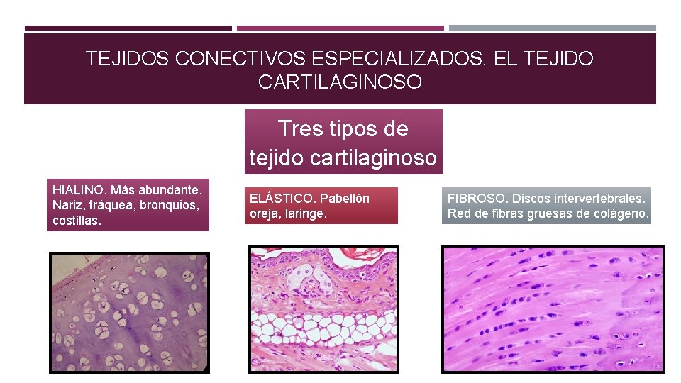 TEJIDOS CONECTIVOS ESPECIALIZADOS. EL TEJIDO CARTILAGINOSO Tres tipos de tejido cartilaginoso HIALINO. Más abundante.