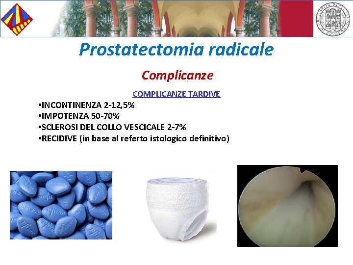 Prostatectomia radicale Complicanze COMPLICANZE TARDIVE • INCONTINENZA 2 -12, 5% • IMPOTENZA 50 -70%