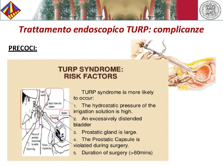 Trattamento endoscopico TURP: complicanze PRECOCI: 