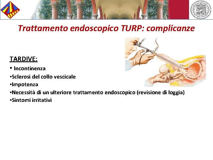 Trattamento endoscopico TURP: complicanze TARDIVE: • Incontinenza • Sclerosi del collo vescicale • Impotenza