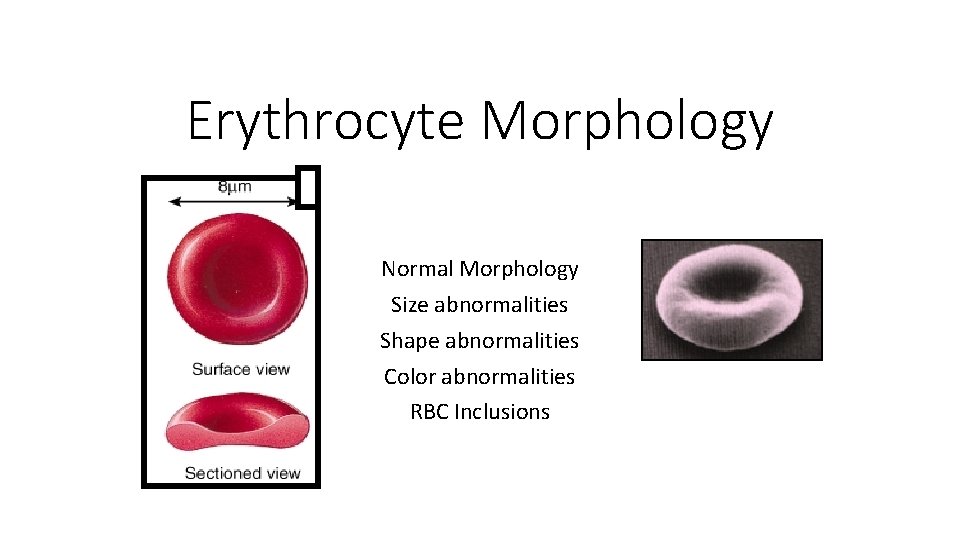 Erythrocyte Morphology Normal Morphology Size abnormalities Shape abnormalities Color abnormalities RBC Inclusions 