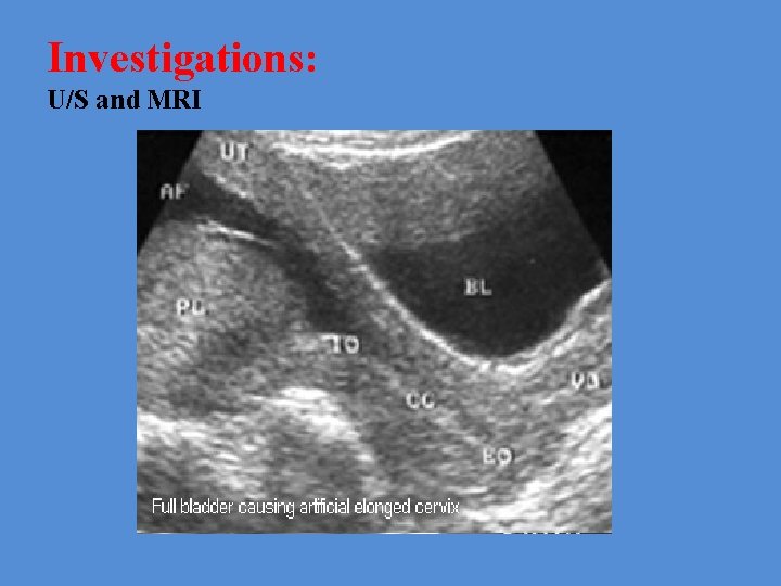 Investigations: U/S and MRI 