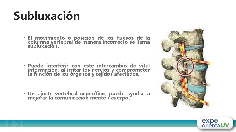 Subluxación • El movimiento o posición de los huesos de la columna vertebral de