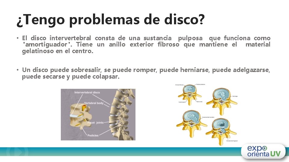 ¿Tengo problemas de disco? • El disco intervertebral consta de una sustancia pulposa que