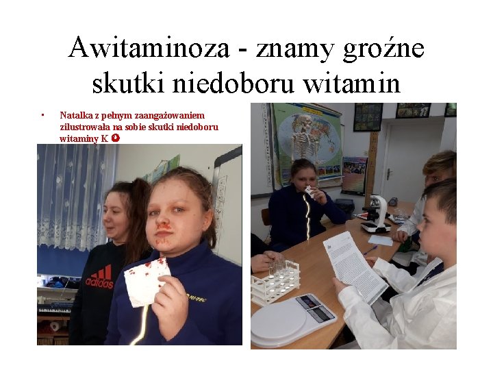 Awitaminoza - znamy groźne skutki niedoboru witamin • Natalka z pełnym zaangażowaniem zilustrowała na Awitaminoza - znamy groźne skutki niedoboru witamin • Natalka z pełnym zaangażowaniem zilustrowała na