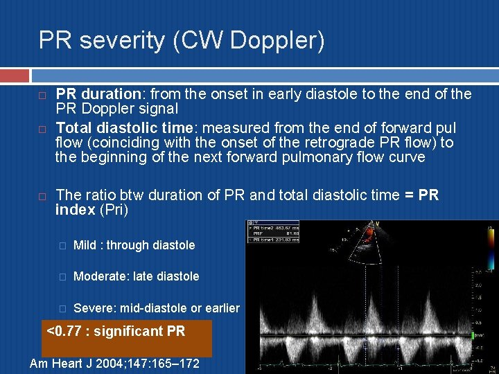PR severity (CW Doppler) PR duration: from the onset in early diastole to the