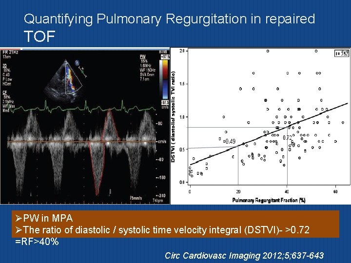 Quantifying Pulmonary Regurgitation in repaired TOF ØPW in MPA ØThe ratio of diastolic /