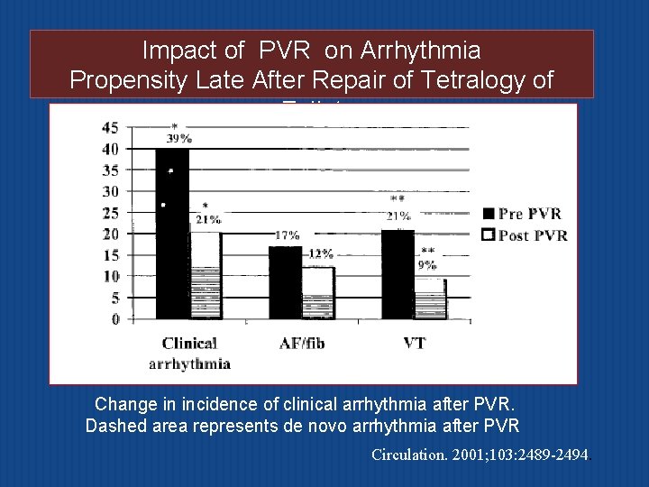 Impact of PVR on Arrhythmia Propensity Late After Repair of Tetralogy of Fallot Change