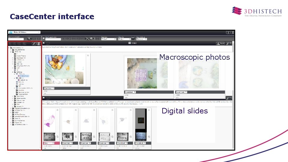 Case. Center interface Macroscopic photos Digital slides 