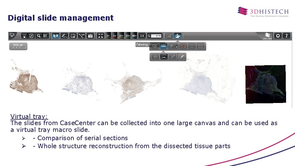 Digital slide management Virtual tray: The slides from Case. Center can be collected into