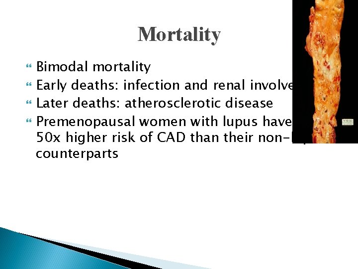 Mortality Bimodal mortality Early deaths: infection and renal involvement Later deaths: atherosclerotic disease Premenopausal