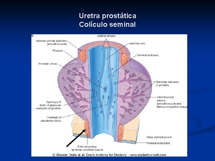 Uretra prostática Colículo seminal 