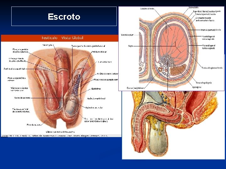 Escroto 