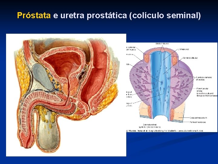Próstata e uretra prostática (colículo seminal) 