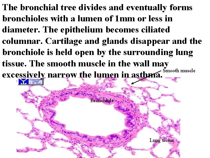 The bronchial tree divides and eventually forms bronchioles with a lumen of 1 mm