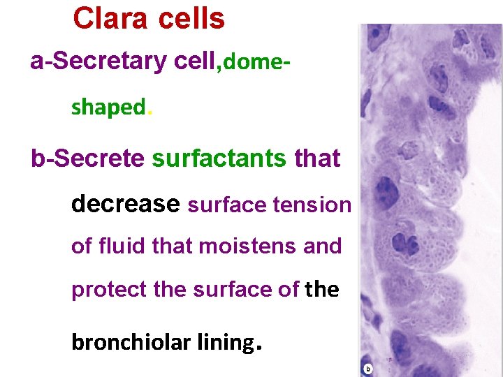 Clara cells a-Secretary cell, domeshaped. b-Secrete surfactants that decrease surface tension of fluid that