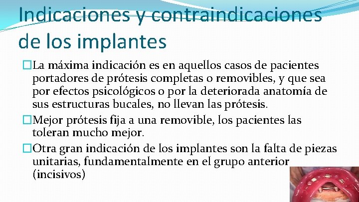 Indicaciones y contraindicaciones de los implantes �La máxima indicación es en aquellos casos de