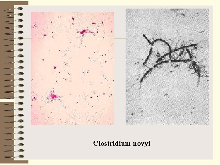 Chair of Microbiology Virology and Immunology Yersinia Francisella