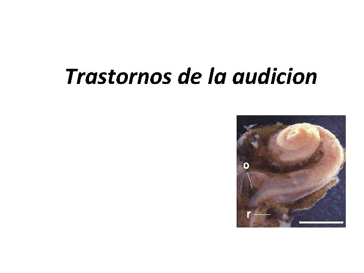 Trastornos de la audicion 