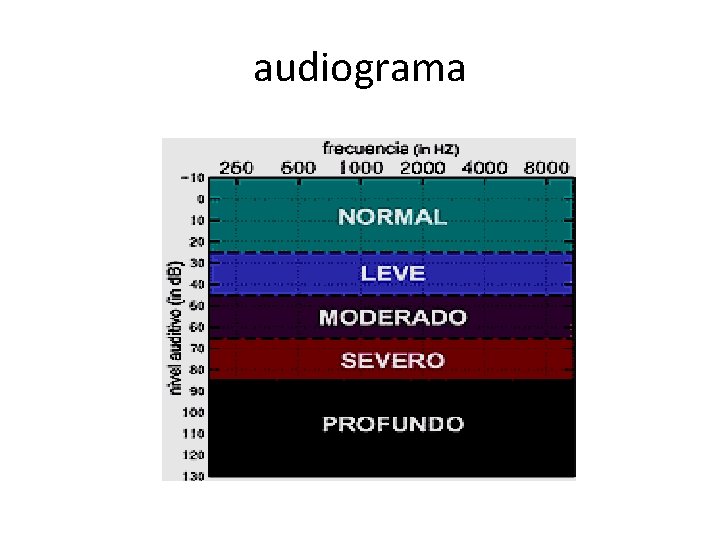 audiograma 