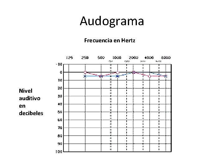 Audograma Frecuencia en Hertz Nivel auditivo en decibeles 