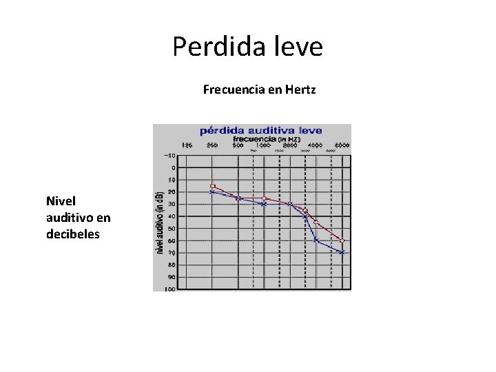 Perdida leve Frecuencia en Hertz Nivel auditivo en decibeles 