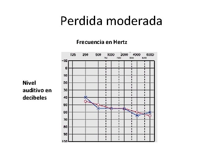 Perdida moderada Frecuencia en Hertz Nivel auditivo en decibeles 