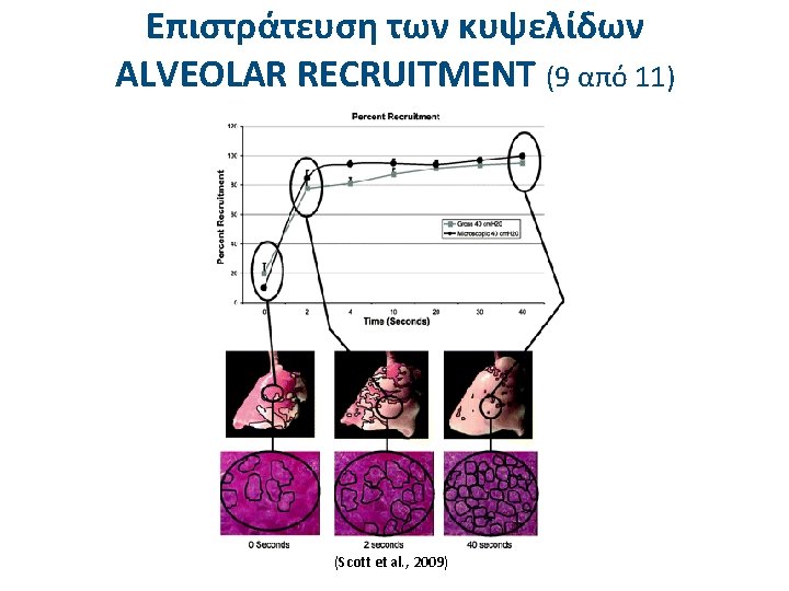 Επιστράτευση των κυψελίδων ALVEOLAR RECRUITMENT (9 από 11) (Scott et al. , 2009) 