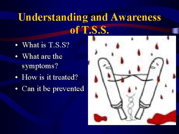 Understanding and Awareness of T. S. S. • What is T. S. S? •