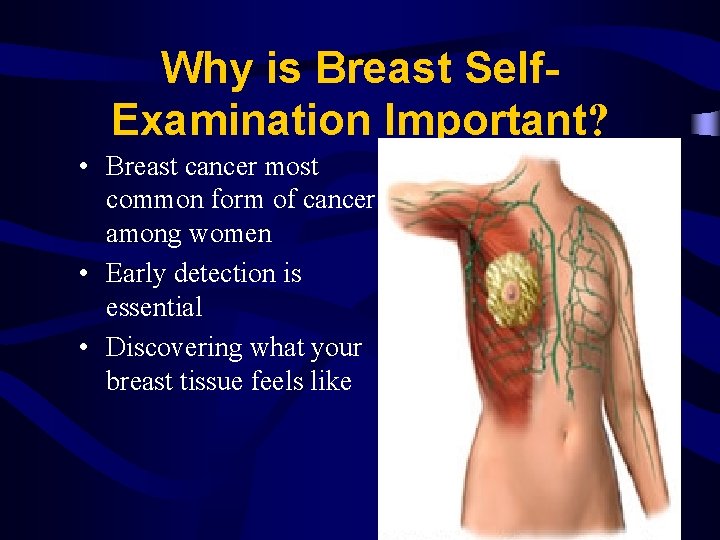 Why is Breast Self. Examination Important? • Breast cancer most common form of cancer