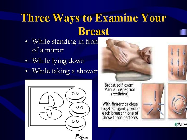 Three Ways to Examine Your Breast • While standing in front of a mirror