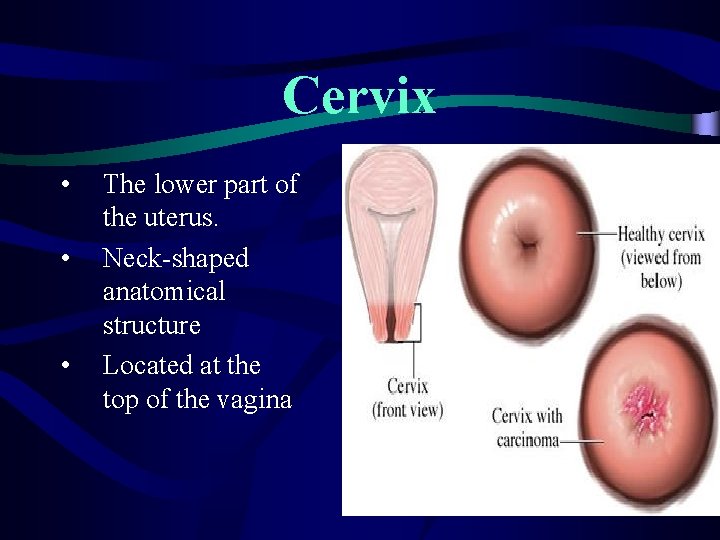Cervix • • • The lower part of the uterus. Neck-shaped anatomical structure Located